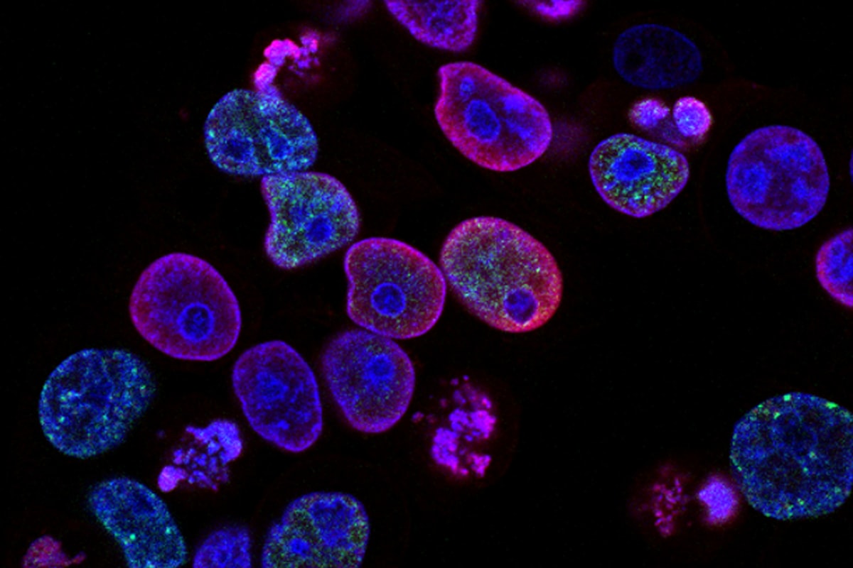 محتوى إبداعي لـ Novo Genomics
